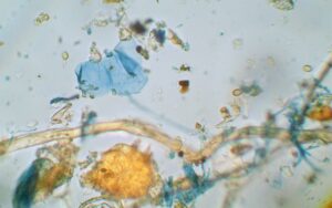 Dust Identification. Order Online.